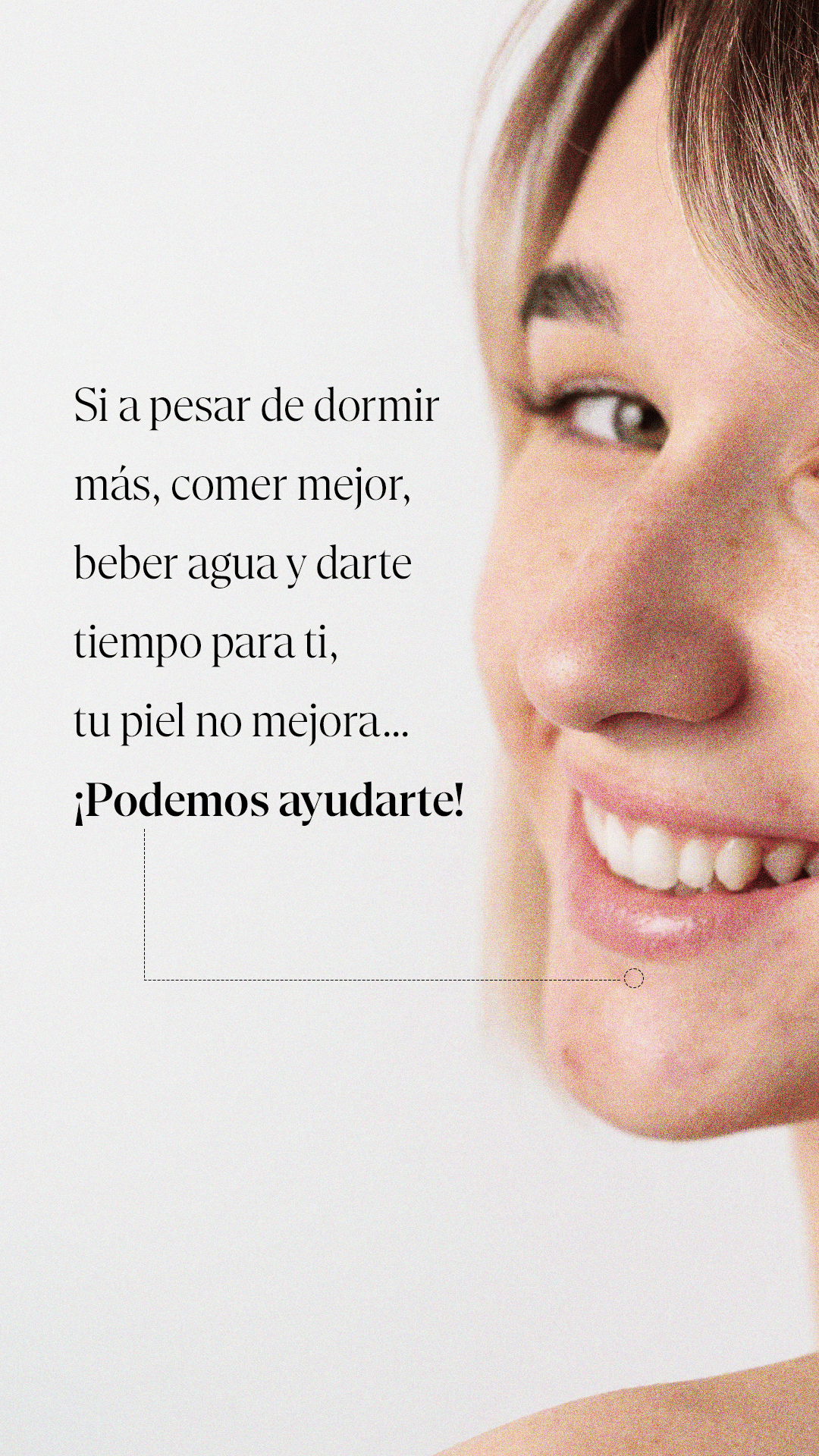 181124-Fermentaris-s3